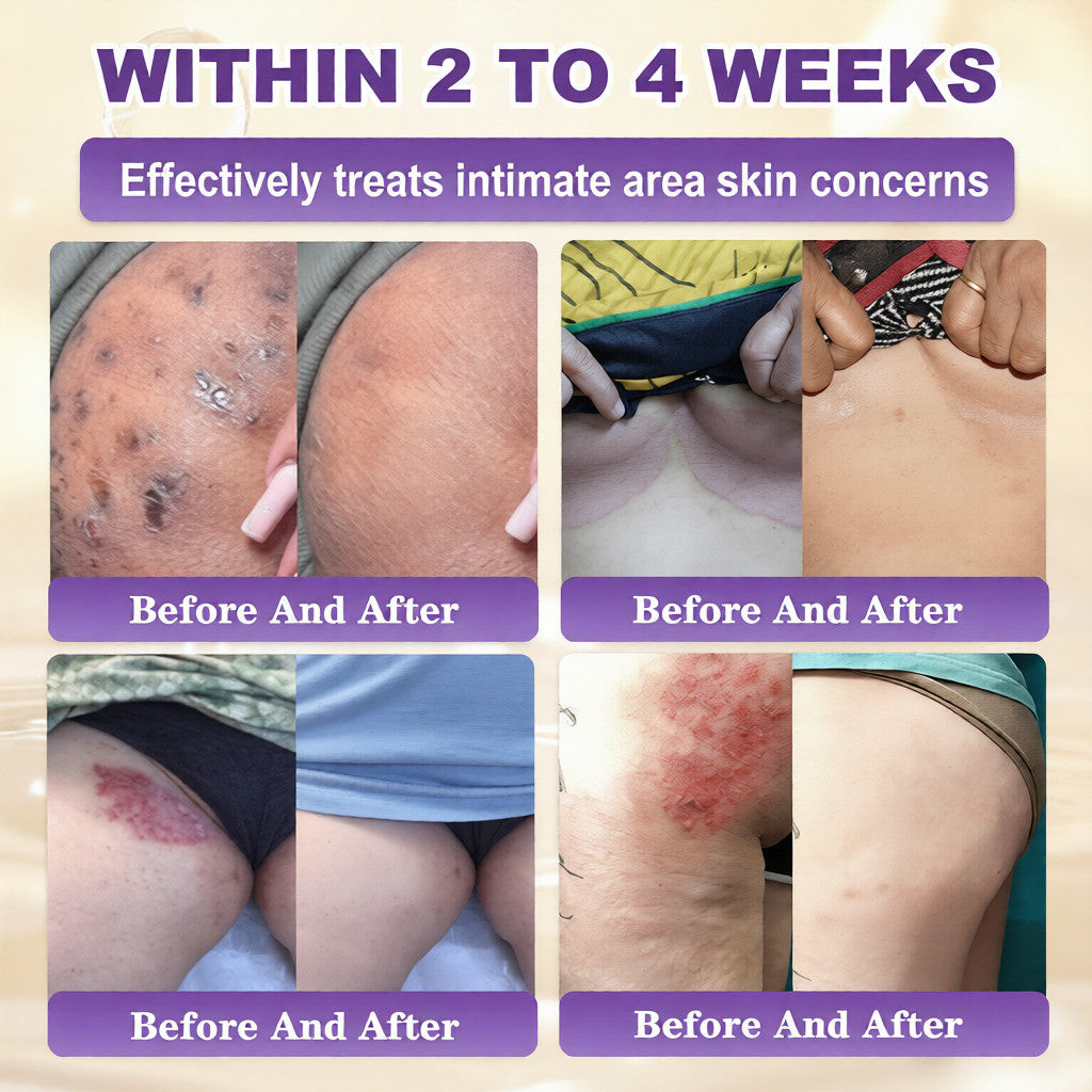 𝐔𝐒𝐀 𝐃𝐨𝐜𝐭𝐨𝐫 𝐑𝐞𝐜𝐨𝐦𝐦𝐞𝐧𝐝𝐞𝐝🌟 | QIAWI® 𝑩𝒊𝒐𝒕𝒊𝒏 𝟏𝟎-𝗶𝙣-𝟏 𝑺𝒌𝒊𝒏 𝑹𝒆𝒔𝒕𝒐𝒓𝒂𝒕𝒊𝒐𝒏 𝑪𝒓𝒆𝒂𝒎 |✅𝘉𝘢𝘤𝘬𝘦𝘥 𝘣𝘺 𝘴𝘤𝘪𝘦𝘯𝘤𝘦 | 10-1 𝖿𝗈𝗋𝗆𝗎𝗅𝖺 | 𝑅𝑒𝑠𝑢𝑙𝑡𝑠 𝑖𝑛 7 𝑑𝑎𝑦𝑠 🏅