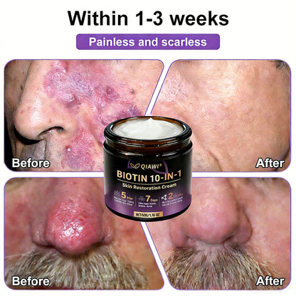 𝐔𝐒𝐀 𝐃𝐨𝐜𝐭𝐨𝐫 𝐑𝐞𝐜𝐨𝐦𝐦𝐞𝐧𝐝𝐞𝐝🌟 | QIAWI® 𝑩𝒊𝒐𝒕𝒊𝒏 𝟏𝟎-𝗶𝙣-𝟏 𝑺𝒌𝒊𝒏 𝑹𝒆𝒔𝒕𝒐𝒓𝒂𝒕𝒊𝒐𝒏 𝑪𝒓𝒆𝒂𝒎 |✅𝘉𝘢𝘤𝘬𝘦𝘥 𝘣𝘺 𝘴𝘤𝘪𝘦𝘯𝘤𝘦 | 10-1 𝖿𝗈𝗋𝗆𝗎𝗅𝖺 | 𝑅𝑒𝑠𝑢𝑙𝑡𝑠 𝑖𝑛 7 𝑑𝑎𝑦𝑠 🏅