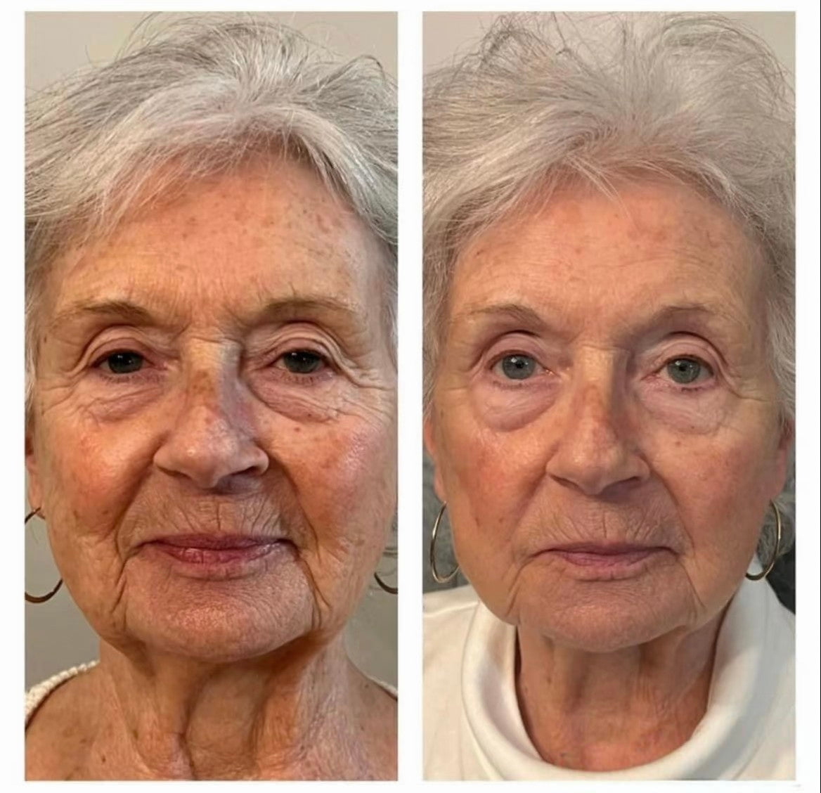 Roller Massage Neck Cream 🧴 Collagen & Hyaluronic Acid | Firms Neck, Reduces Wrinkles & Double Chin